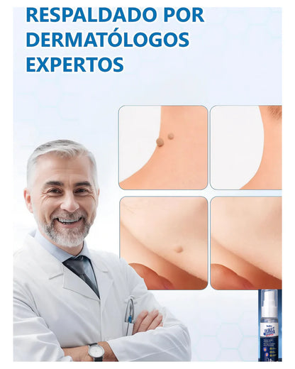 Eliminador de Verrugas™